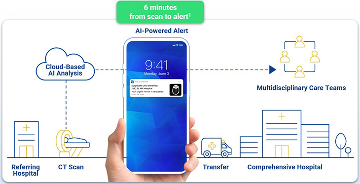 Sketches of a hospital, CT scanner, cell phone and ambulance show the process of using the Viz.ai system to refer a stroke patient from a referring hospital to a comprehensive hospital.